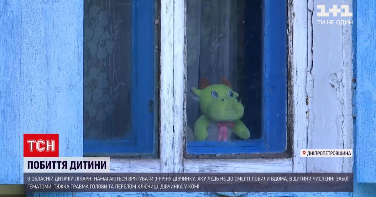Новини України: у Дніпрі рятують трирічну дівчинку з численними переломами та крововиливами