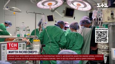 90% не дочекаються! Болісна правда посмертне донорство в Україні від ТСН!
