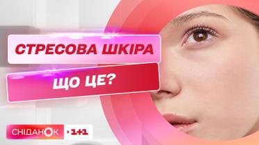 Как уменьшить влияние стресса на здоровье кожи: дерматолог Алина Мантула