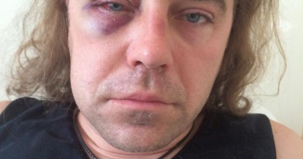 Мірошниченко стверджує, що його побили / © Facebook/Ігор Мірошниченко