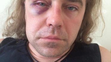 Мірошниченко стверджує, що його побили / © Facebook/Ігор Мірошниченко