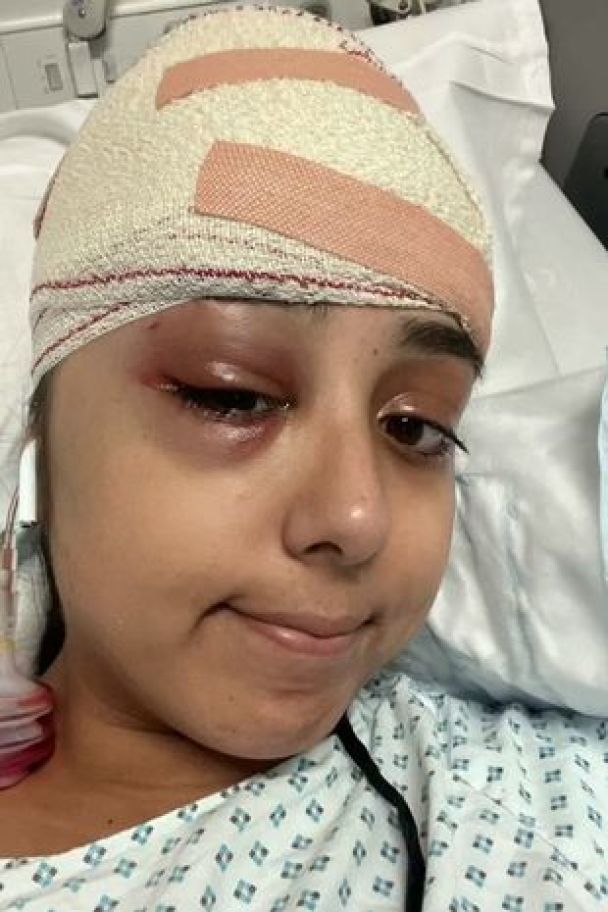 Після жахливої ДТП дівчина показала, який популярний аксесуар для