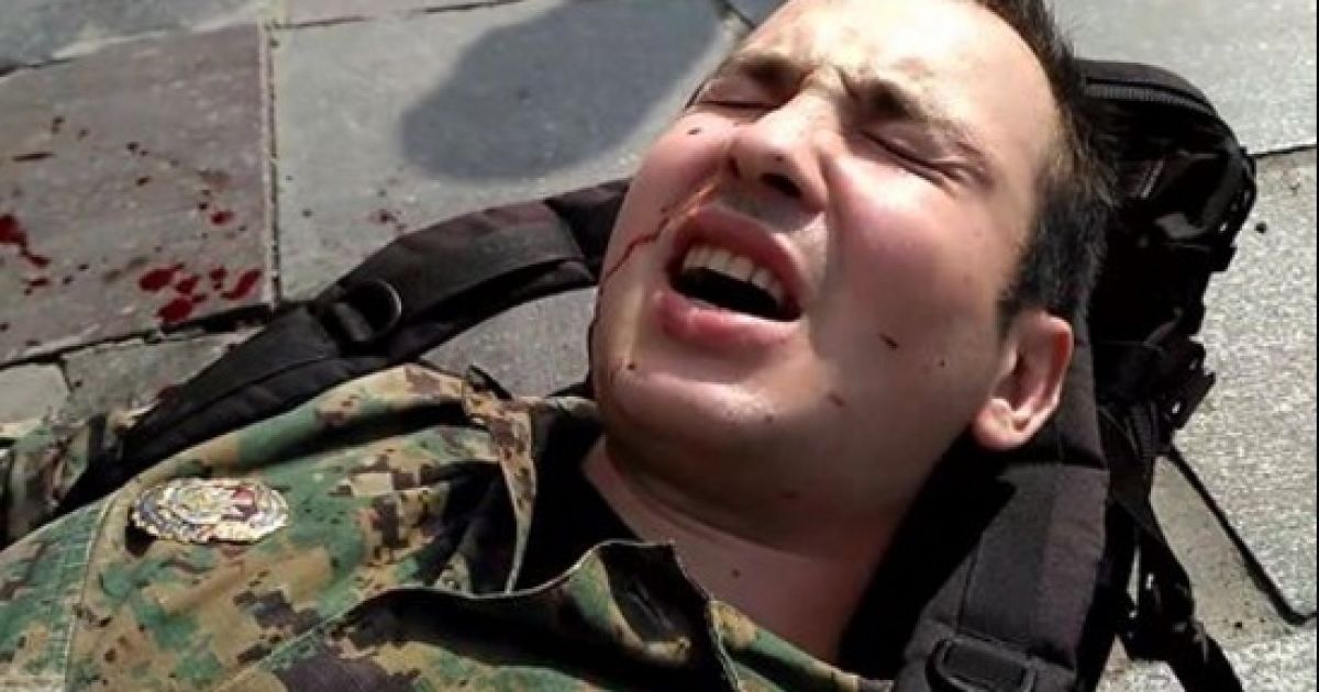 В Киеве мужчину в военной форме восемь раз ударили ножом