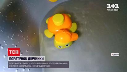 Новини України: у Дніпрі рятують однорічну дівчинку, яка стрибнула у ванну з окропом