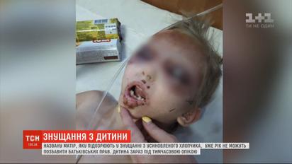 Была, колола иглами и морила голодом - приемная мать пытала усыновленного сына