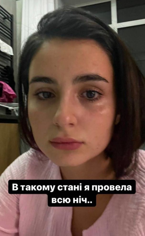 Анна Тринчер отравилась / © instagram.com/annatrincher_official