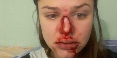 Киевский психолог публично заявила о домашнем насилии со стороны мужа. Луценко ждет заявления