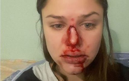 Киевский психолог публично заявила о домашнем насилии со стороны мужа. Луценко ждет заявления