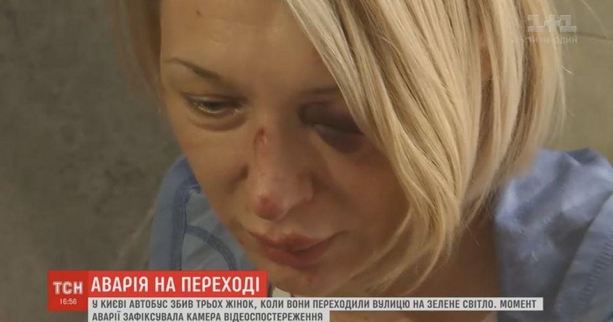 Пострадавшая под колесами маршрутки женщина рассказала подробности аварии