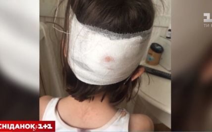 Скандал в столичной школе: ребенку с разбитой головой не вызвали скорую