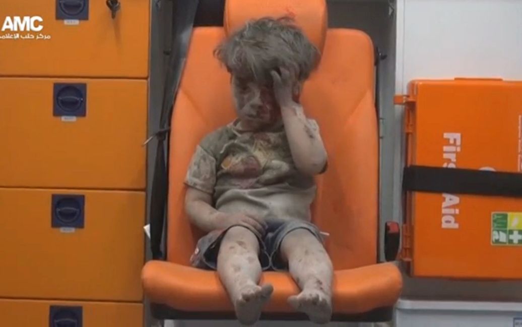 Поранений 5-річний хлопчик Омран / © Reuters