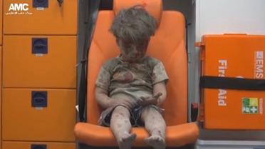 Поранений 5-річний хлопчик Омран / © Reuters