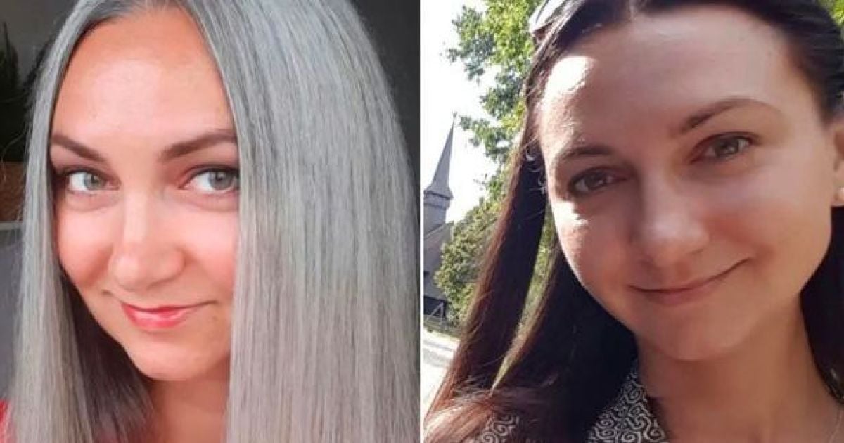 Дівчина неочікувано посивіла у 10 років: "Мене сприймали за бабусю ...