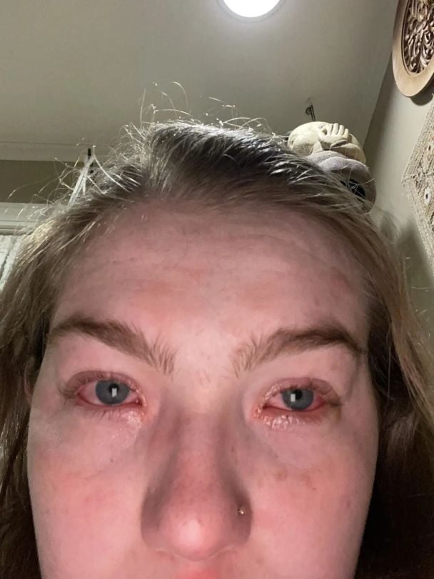 Реакция Вирджинии на любимого / © nypost.com