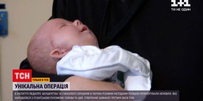 В Україні вперше успішно прооперували немовля з пухлиною розміром з голову