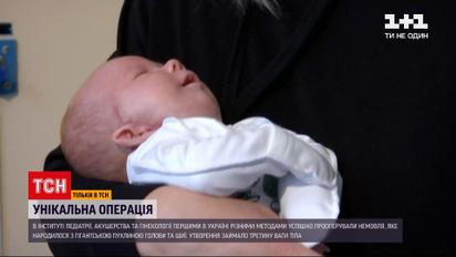 В Україні вперше успішно прооперували немовля з пухлиною розміром з голову