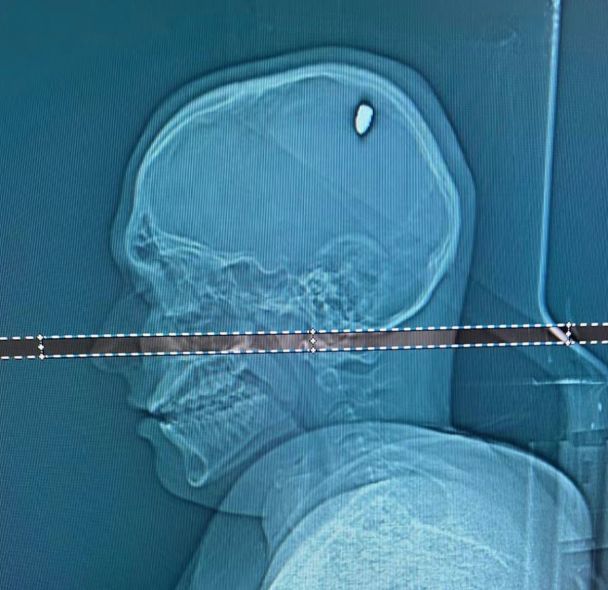 Матеус Фасіо / © dailystar.co.uk