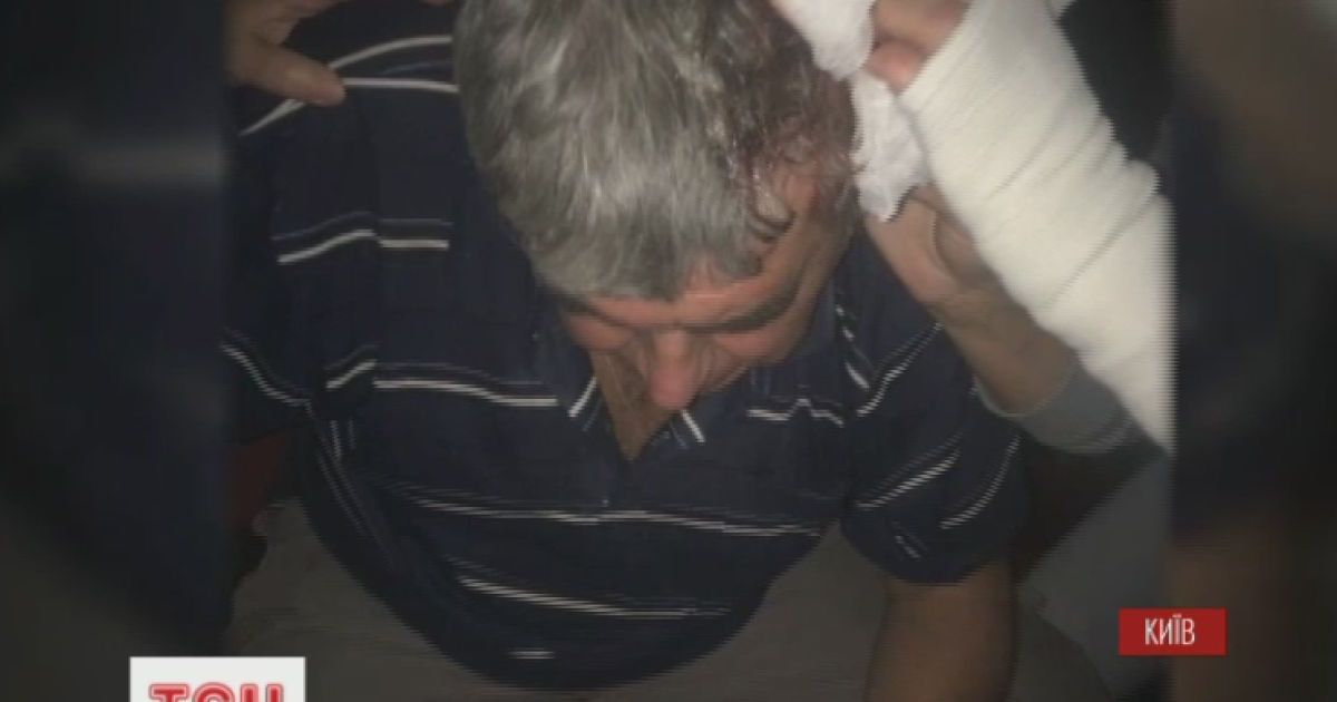 У сутичках під час спроби захопити у столиці комунальне підприємство постраждало троє осіб