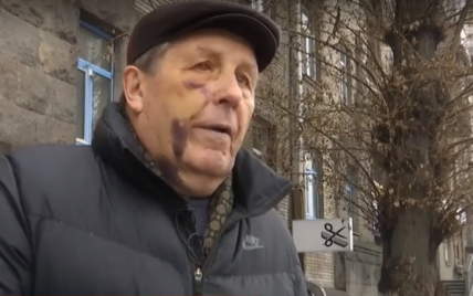 У Києві побили авіаконструктора. Він звинуватив поліцейських