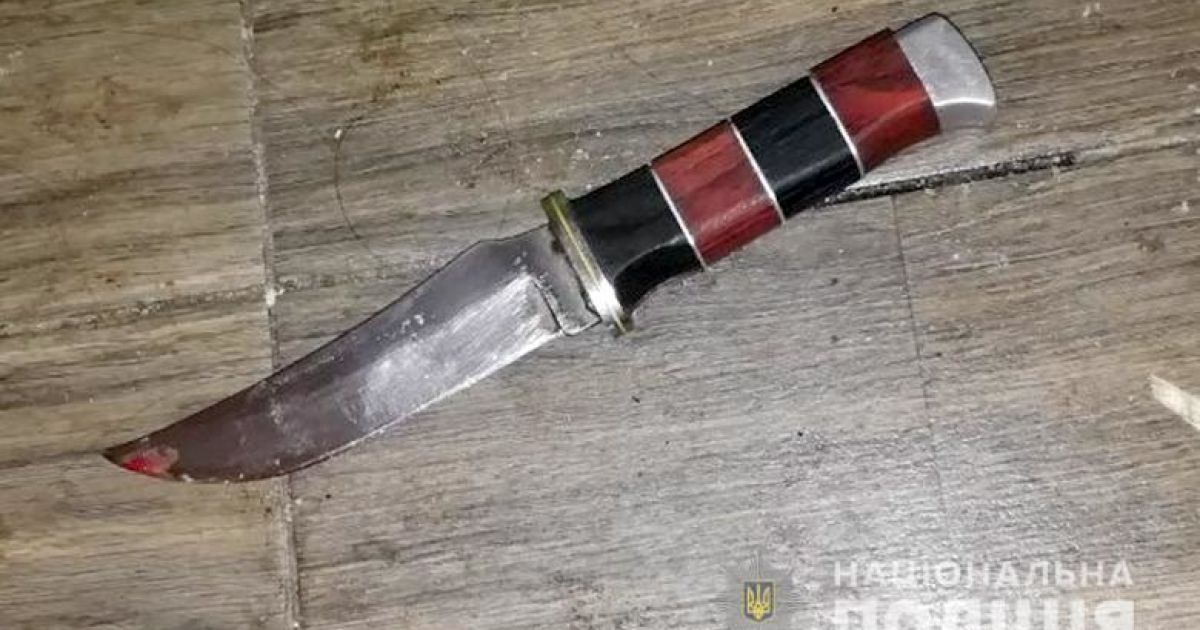 Рівнянка викликала собі швидку і запевнила, що їй завдав ножового поранення в груди 2-річний син