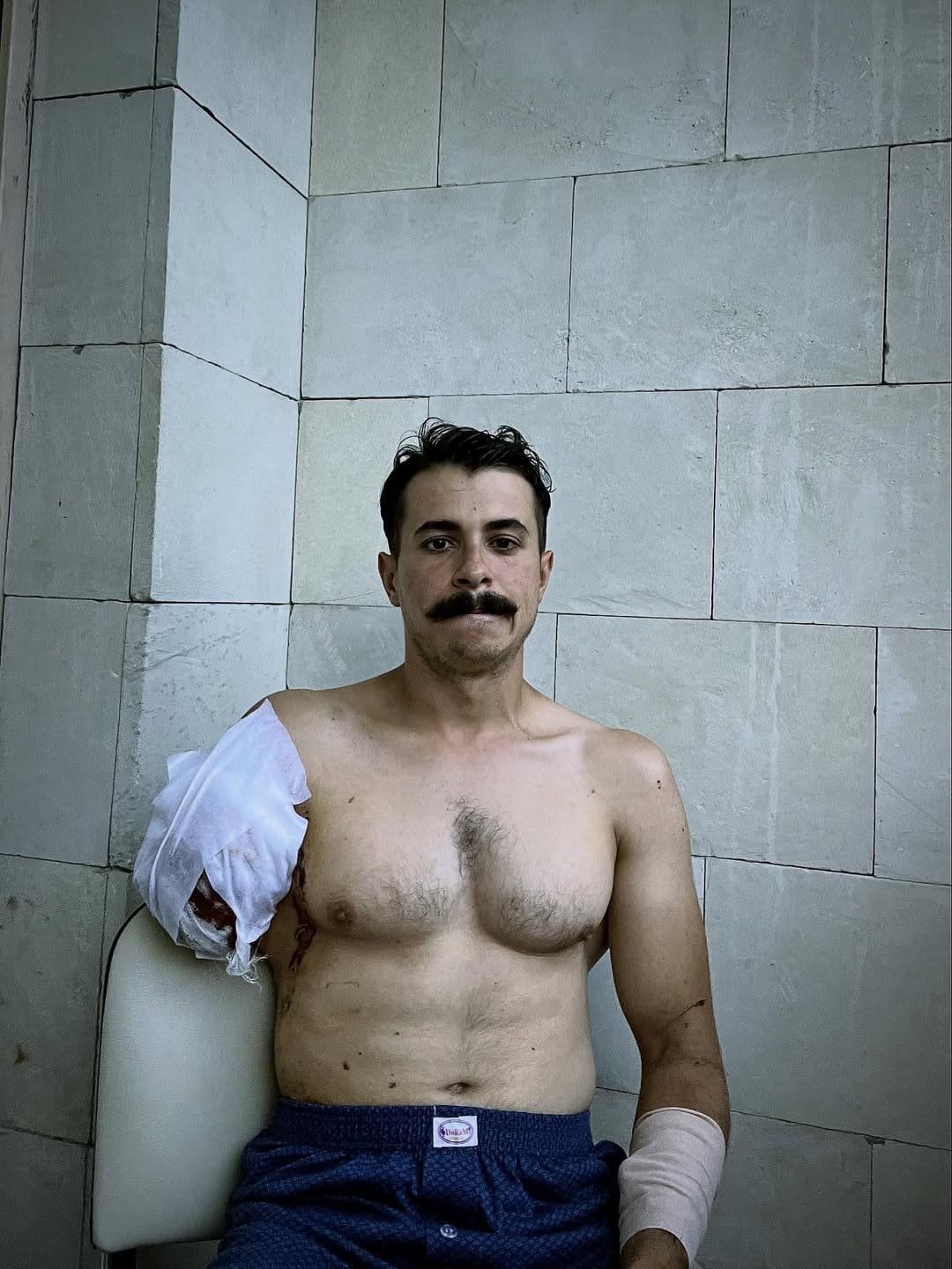 Сын Грубича Ярослав показал новое фото с ампутированной рукой и сделал  заявление с просьбой: фото — Гламур