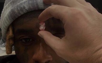 Американський репер Ліл Узі Верт імплантує в лоб рожевий діамант за 24 млн доларів