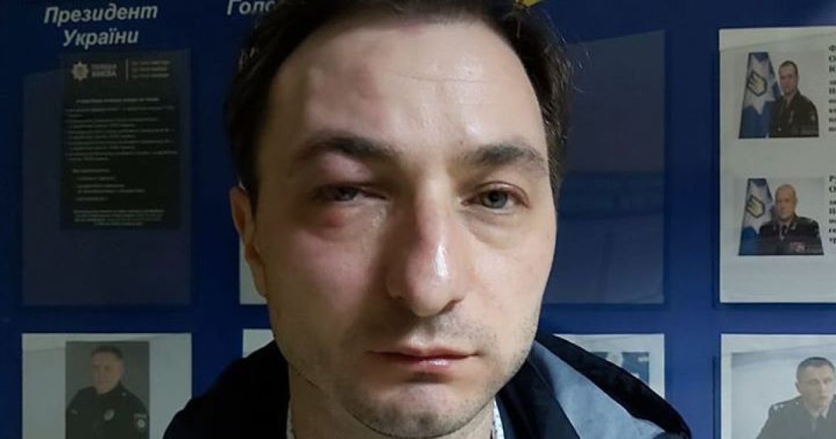 "Дно, привет". В Киеве избили главного врача Института рака