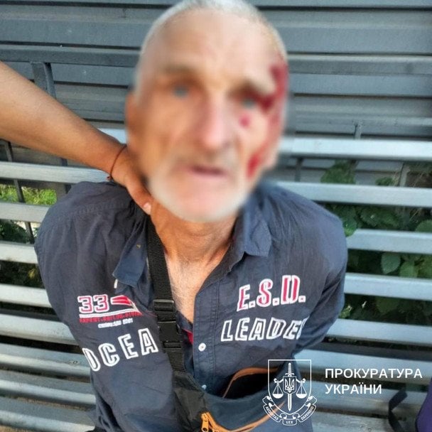 Рецидивіст лише влітку вийшов з в’язниці / © Київська міська прокуратура