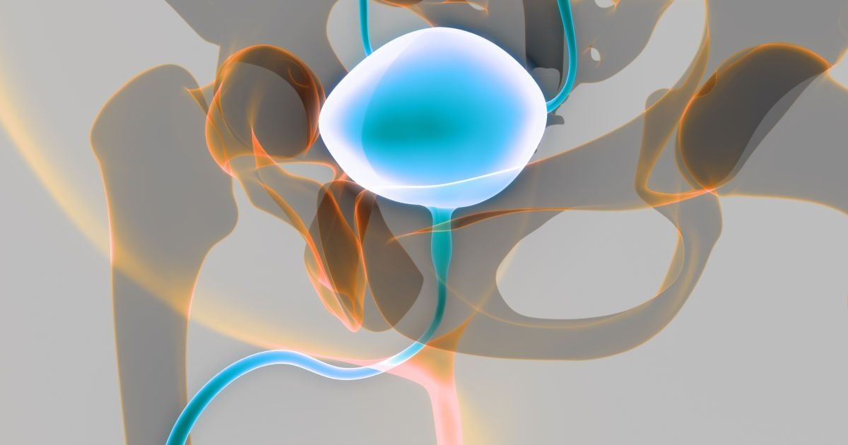 Рак сечового міхура: симптоми, діагностика та лікування