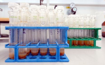 Коронавирус во Львовской области: местные лаборатории не могут справиться с объемами ПЦР-тестирований