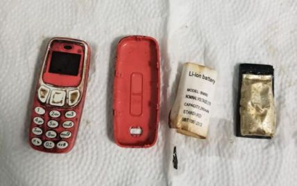 В Косово мужчина проглотил мобильный телефон: как врачи спасали чудака