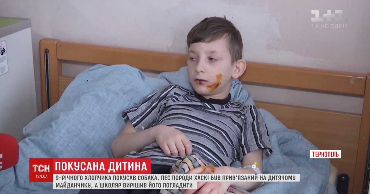 Погрыз лицо и тело. На детской площадке в Тернополе агрессивный пес напал на школьника