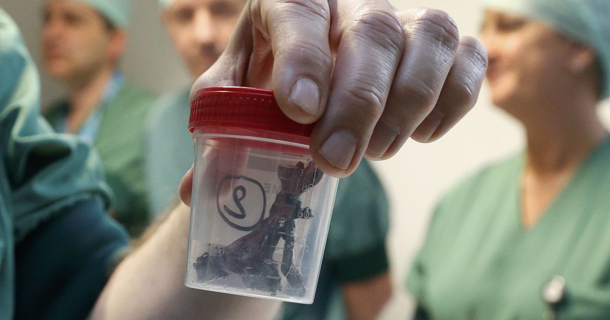 Врачи показали щматки шраплені, которые извлекли из тел раненых. / © Reuters