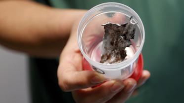 Врачи показали щматки шраплені, которые извлекли из тел раненых. / © Reuters