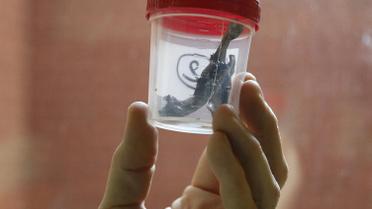 Врачи показали щматки шраплені, которые извлекли из тел раненых. / © Reuters