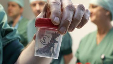 Врачи показали щматки шраплені, которые извлекли из тел раненых. / © Reuters