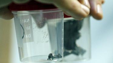 Врачи показали щматки шраплені, которые извлекли из тел раненых. / © Reuters