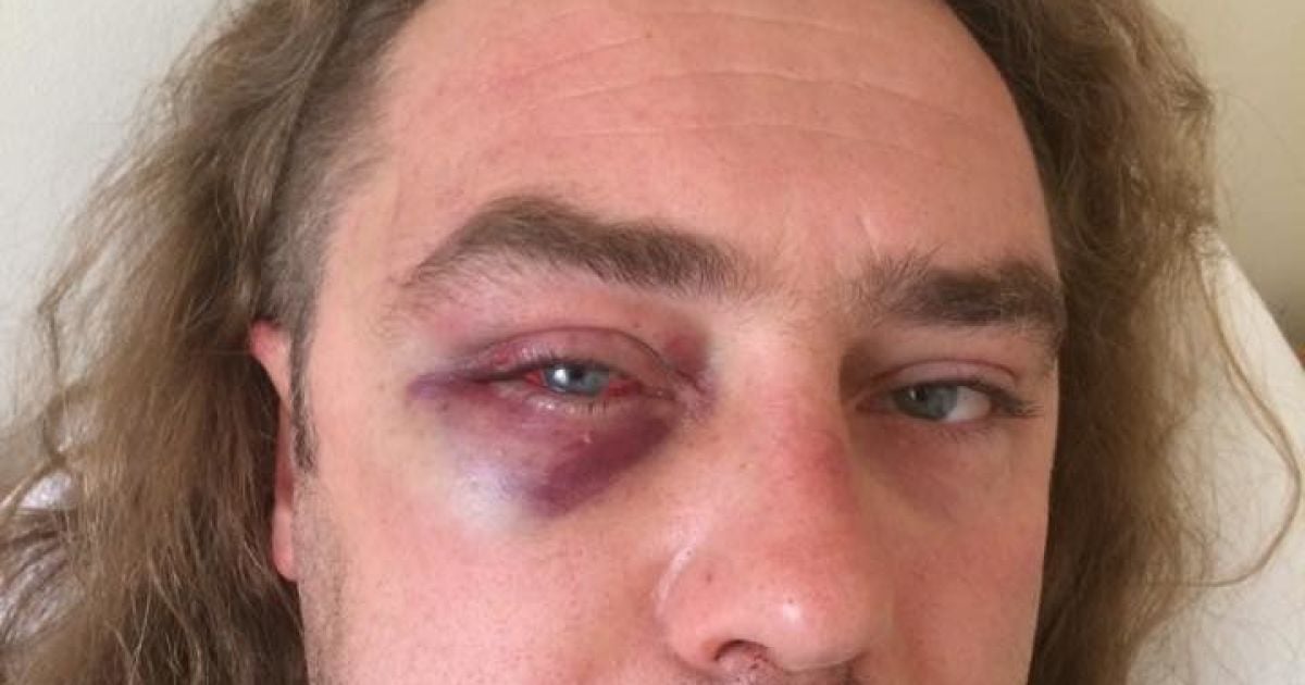 Мірошниченко стверджує, що його побили / © Facebook/Ігор Мірошниченко