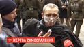 Стабільно тяжкий: медики оцінили стан чоловіка, який підпалив себе під Офісом президента