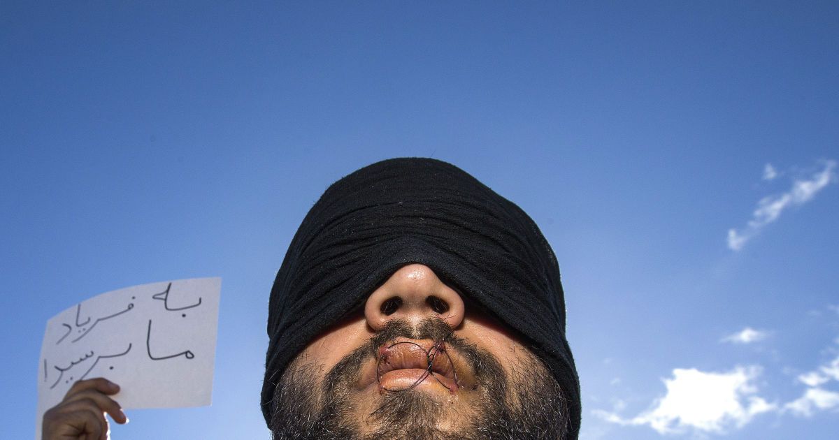 Плакат с надписью "Почему вы не слушаете нас" видно по иранском мигранте, губы которого сшиты в знак протеста против демонтажа лагеря под названием "Джунгли" в Кале, Франция. / © Reuters