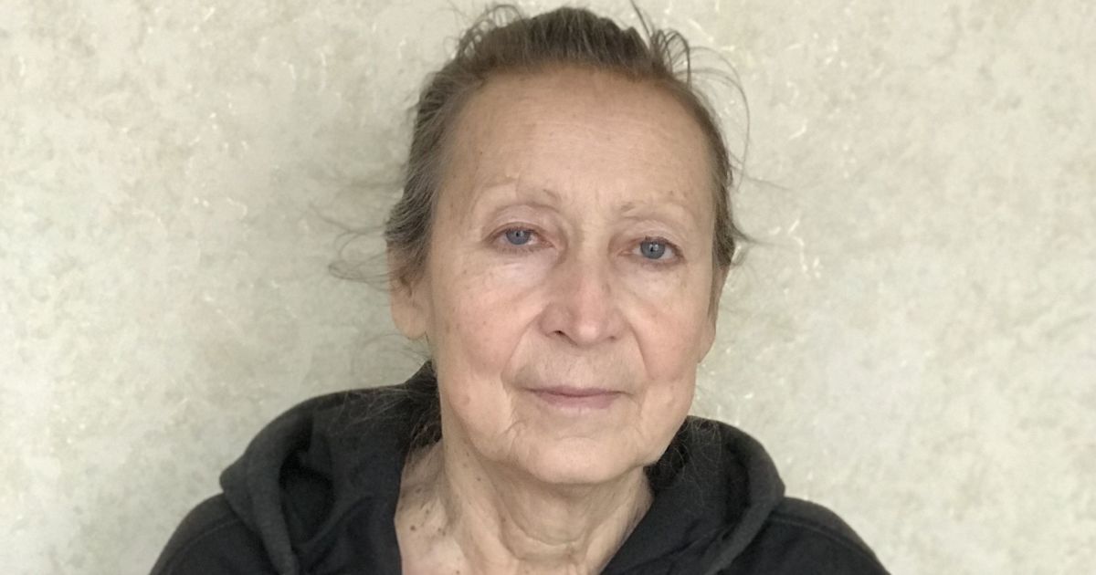 После удаления опухоли с головы Нине нужно лечение