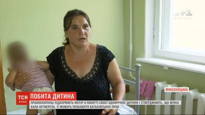 Мешканку Миколаївській області підозрюють у побитті своєї однорічної дитини