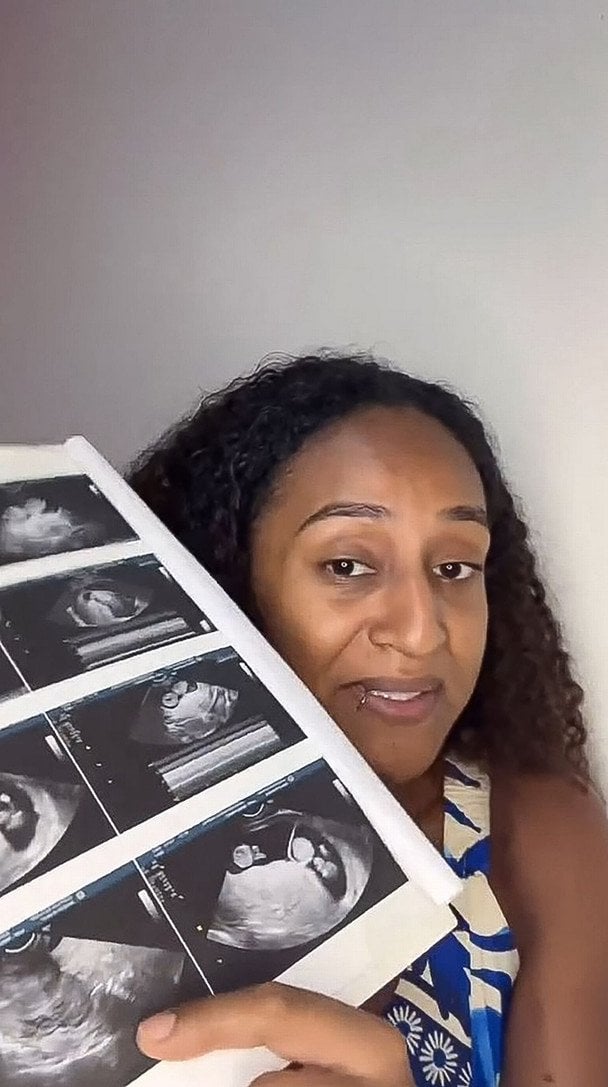  / © dailystar.co.uk