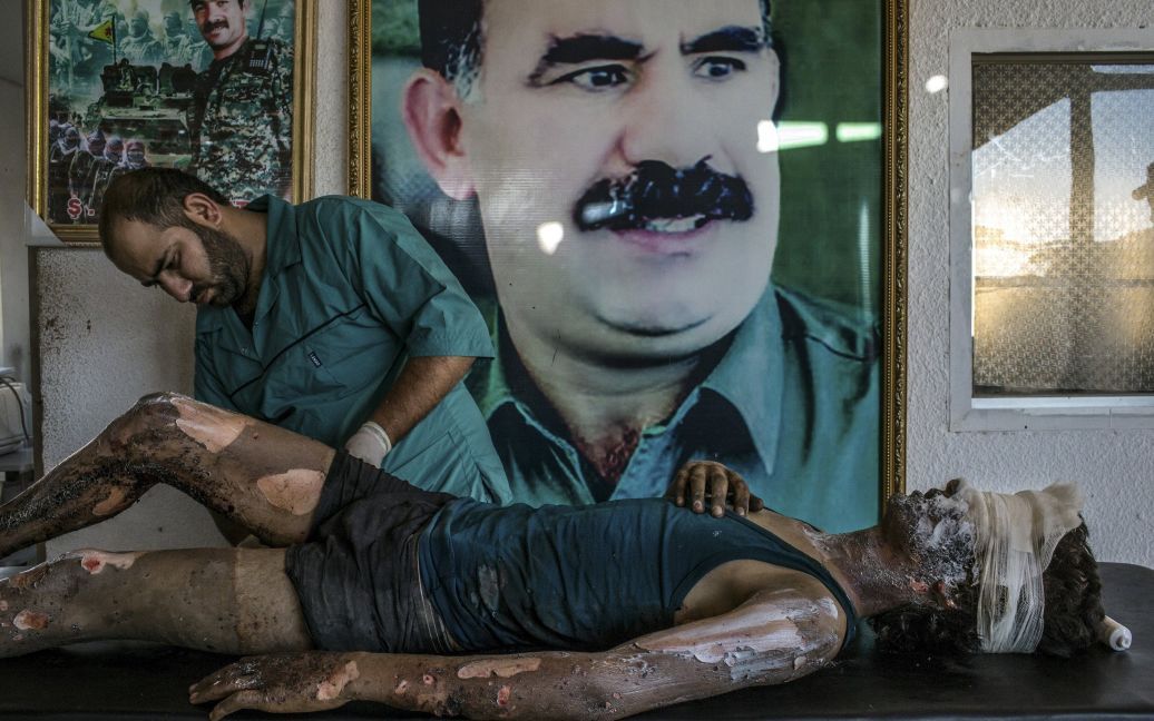 Mauricio Lima "Бойцу обрабатывают раны при курдской больнице". Врач натирает мазь на ожоги 16-летнего Иакова, единственному, кто остался в живых, когда по ним стреляли с истребителей, а впереди висит плакат лидера курдов Абдуллаха Оджалана, находящегося в тюрьме. / © Reuters