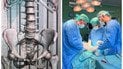 Львівські медики видалили з сечового міхура жінки ртутний термометр