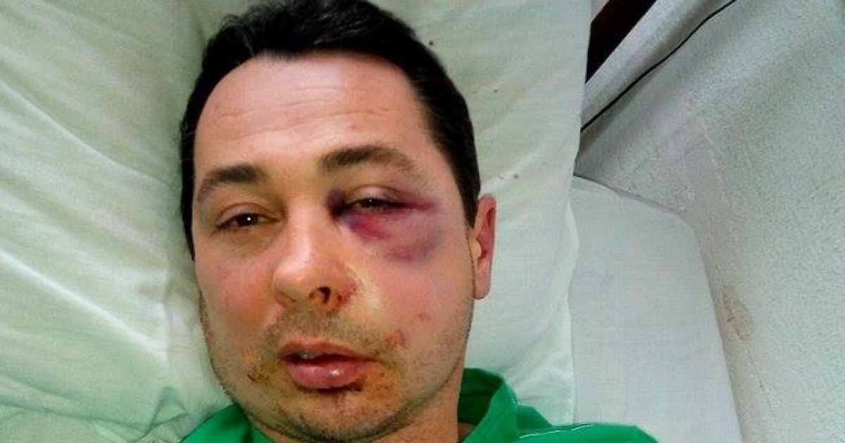 На Херсонщине неизвестные до беспамятства избили депутата Хоминца