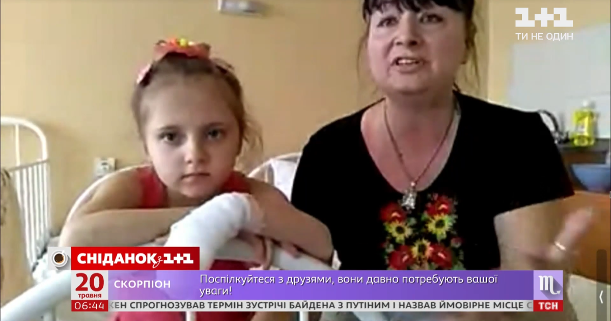 Гангрена, дві операції та пересадка шкіри: чим обернувся для 6-річної дівчинки з Енергодара укус гадюки