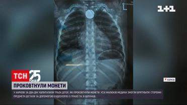 У Харкові за два дні ушпиталили трьох дітей, які проковтнули монети | Новини України