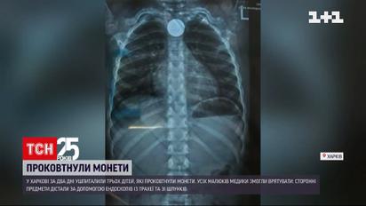 В Харькове за два дня госпитализировали троих детей, проглотивших монеты | Новости Украины