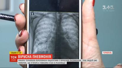 Больницы Тернополя переполнены пациентами с вирусной пневмонией